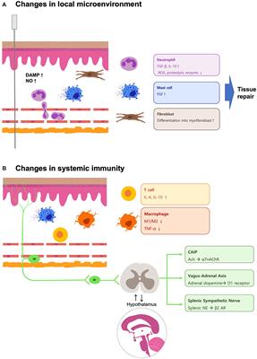 Changes of local microenvironment and systemic immunity after acupuncture stimulation during inflammation: A literature review of animal studies